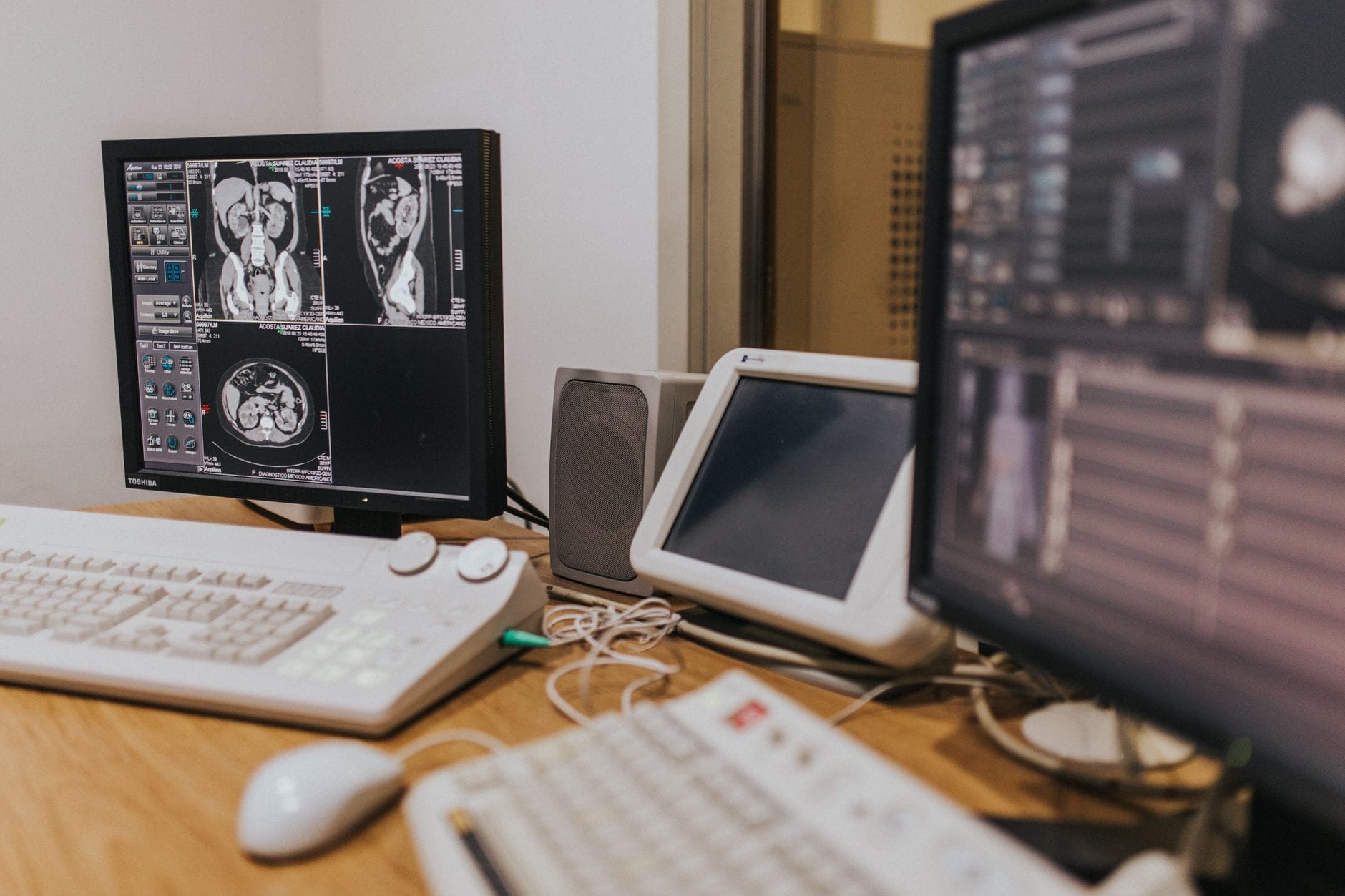 Stanowisko diagnostyczne z obrazami MRI na kilku monitorach