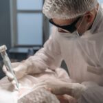 Dermapen czy laser frakcyjny na blizny potrądzikowe: co wybrać przy głębokich ubytkach?